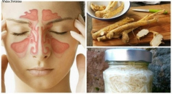 REMEDIOS CASEROS PARA ALIVIAR LA SINUSITIS