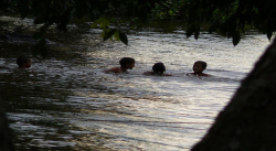 Caribe le arrancó el dedo a niña de 5 años en Puerto Bagre