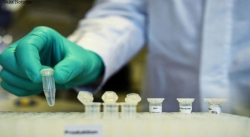 VENEZUELA REGISTRA 1.061 NUEVOS CASOS Y 8 FALLECIDOS POR COVID-19 ESTE LUNES