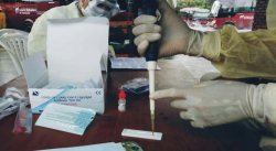 AMAZONAS REPORTÓ 12 NUEVOS CASOS DE COVID-19 ESTE VIERNES