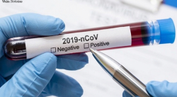 AMAZONAS REGISTRO ESTE JUEVES 2 FALLECIDOS Y 1 PERSONA CONTAGIADA POR COVID-19